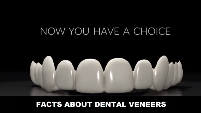dubai-dental-veneers-facts