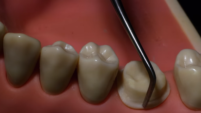 dental-crown-dubai